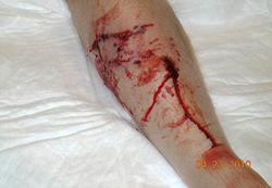 do rottweilers attack their owners bites involving children injury lawyers and attorneys do rottweilers attack their owners bites involving children injury lawyers and attorneys
